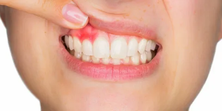 w5a269nH7F3S8lyRyhWad6WgJ7bTV0c3t7GsDLCI