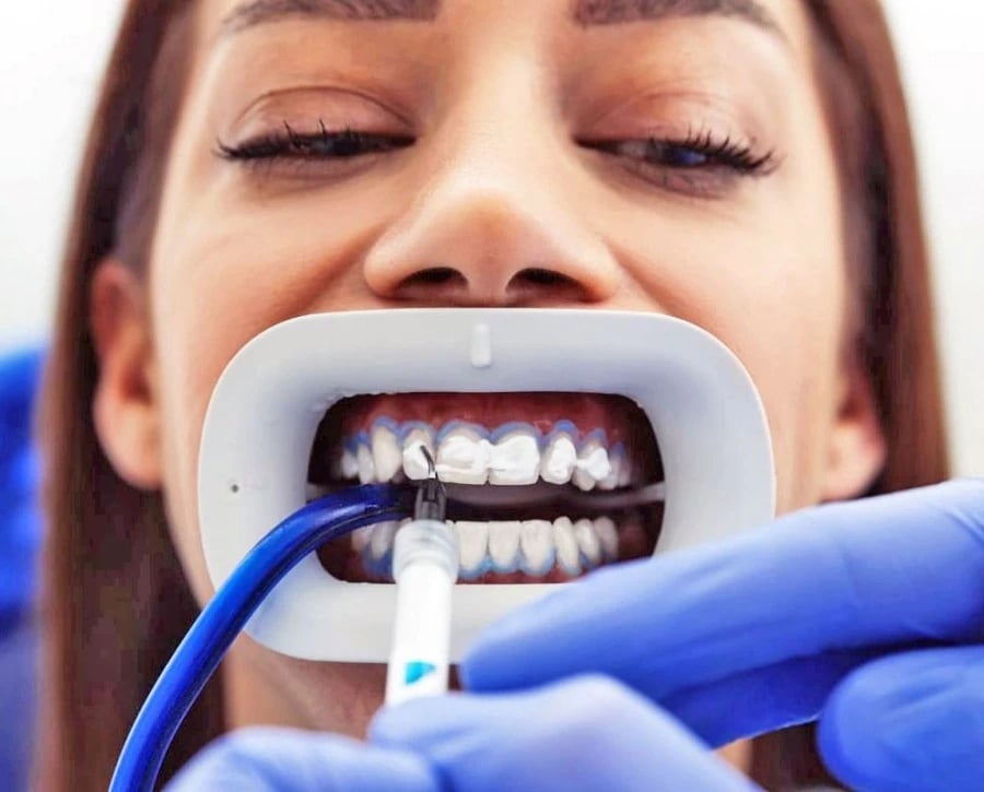 Before and after cosmetic surgery at Smile Center Turkey