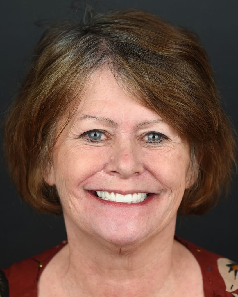 Portrait of a middle-aged woman with shoulder-length brown hair and bright blue eyes, smiling broadly with bright white teeth, wearing a red dress with floral patterns at Smile Center Turkey.