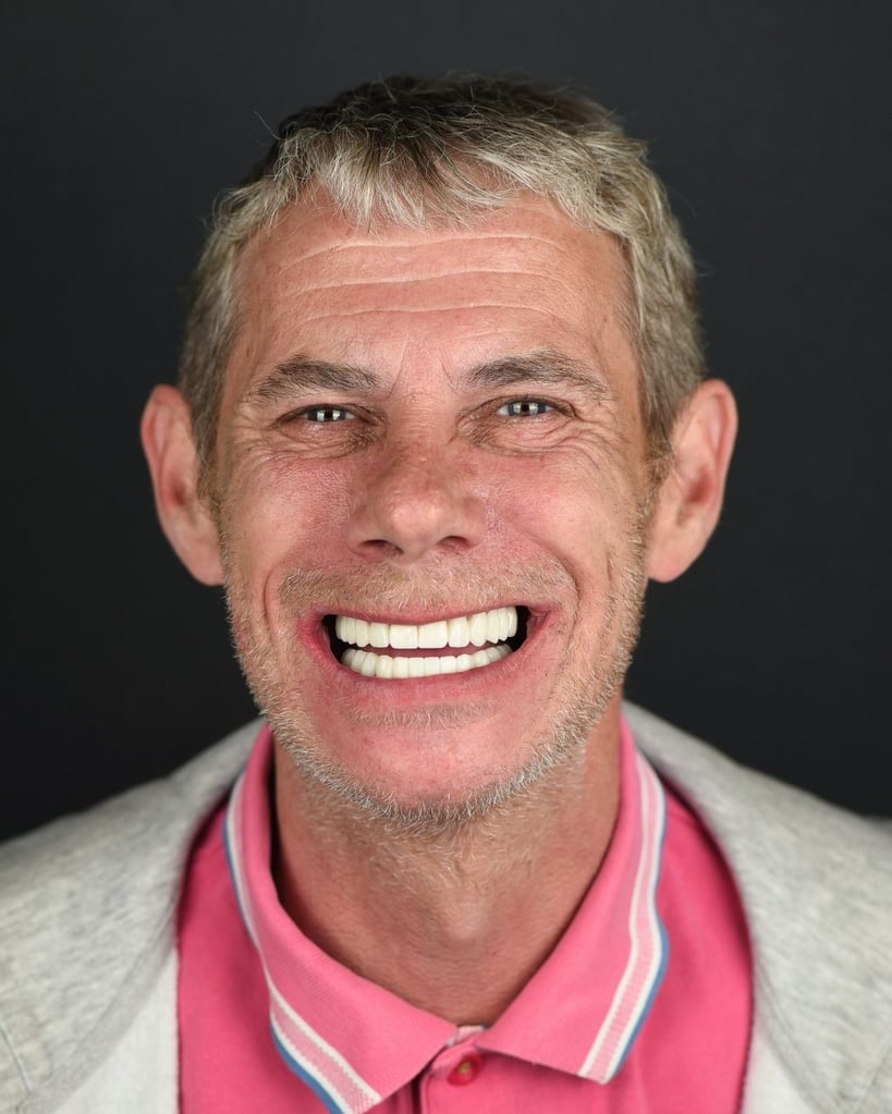 Portrait of a middle-aged man with short grey hair wearing a pink polo shirt and grey jacket, smiling widely to show his new dental restoration at Smile Center Turkey.
