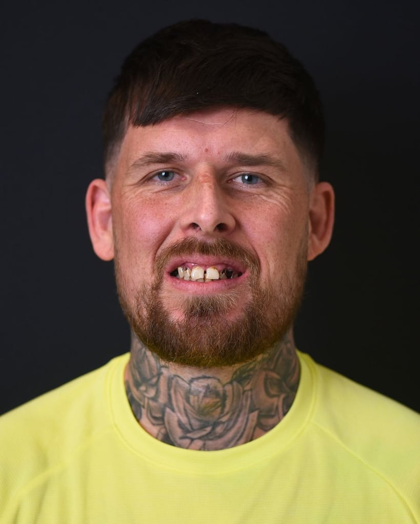 Anthony – Smile Center Turkey®