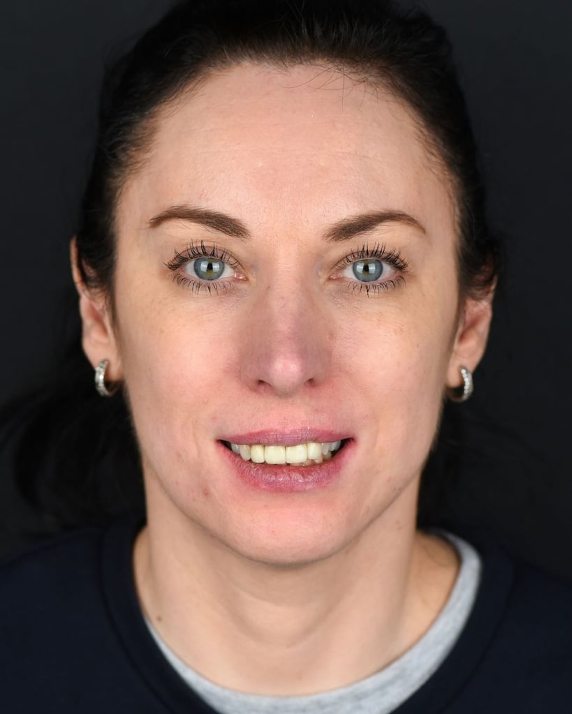 Portrait of a woman with dark hair pulled back and blue-green eyes, wearing a grey top and small hoop earrings, smiling slightly against a dark background at Smile Center Turkey.