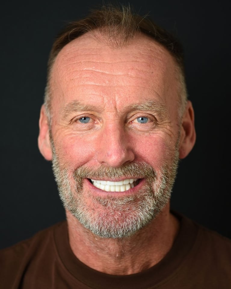 Portrait of a middle-aged man with receding brown hair and a grey beard, wearing a brown shirt, smiling warmly and showing bright white teeth after dental restoration at Smile Center Turkey.