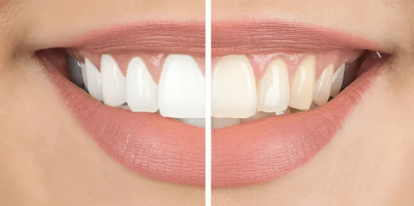 01JE3ZAAJ6D1Z3K3DC1DP8XKHZ