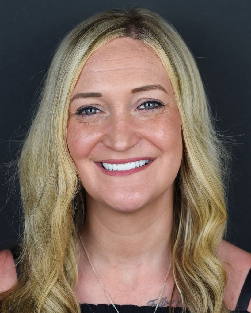 Portrait of a woman with long wavy blonde hair wearing a black top and silver necklace, smiling widely and showing bright white teeth at Smile Center Turkey.