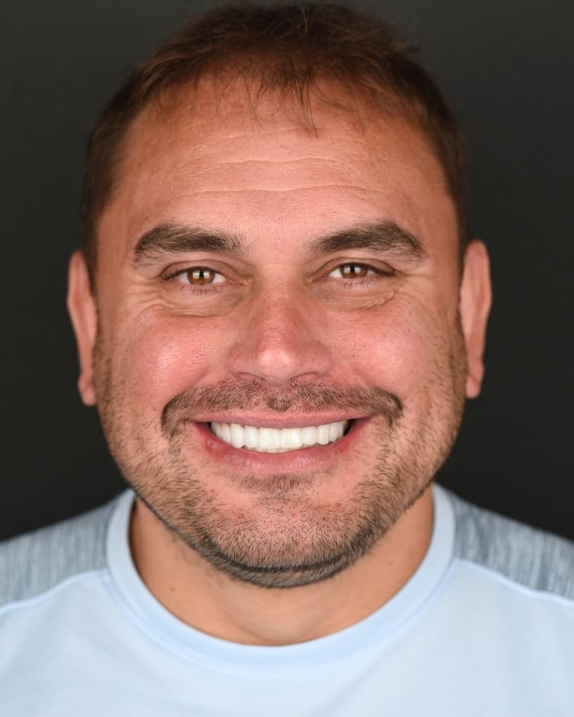Portrait of a middle-aged man with short brown hair and a trimmed beard smiling broadly, showing bright white teeth, wearing a light blue shirt at Smile Center Turkey.
