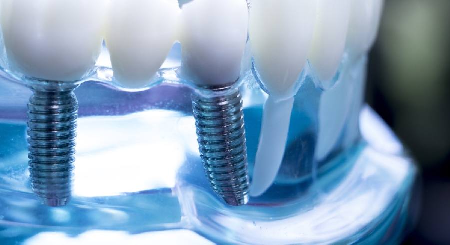 Comprehensive dental services and digital planning at Smile Center Turkey