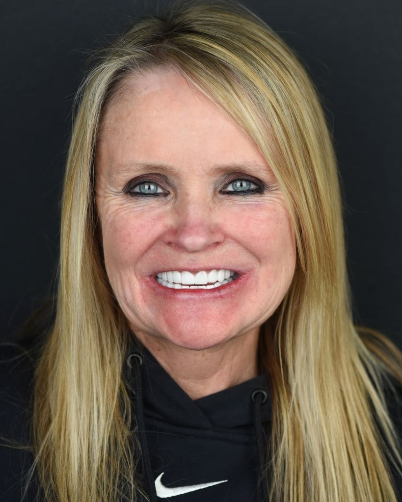 Portrait of a woman with long blonde hair smiling widely and showing bright white teeth at Smile Center Turkey.