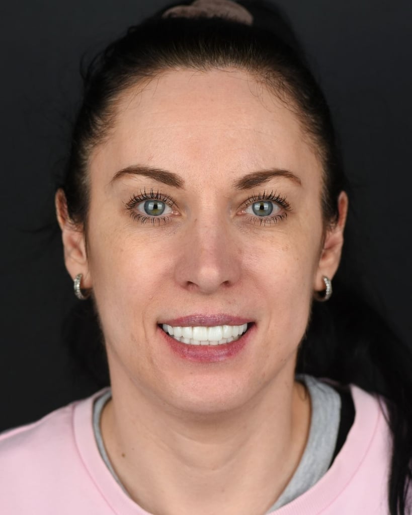 Portrait of a woman with dark hair pulled back and blue-green eyes, wearing a pink sweatshirt and smiling against a dark background at Smile Center Turkey.