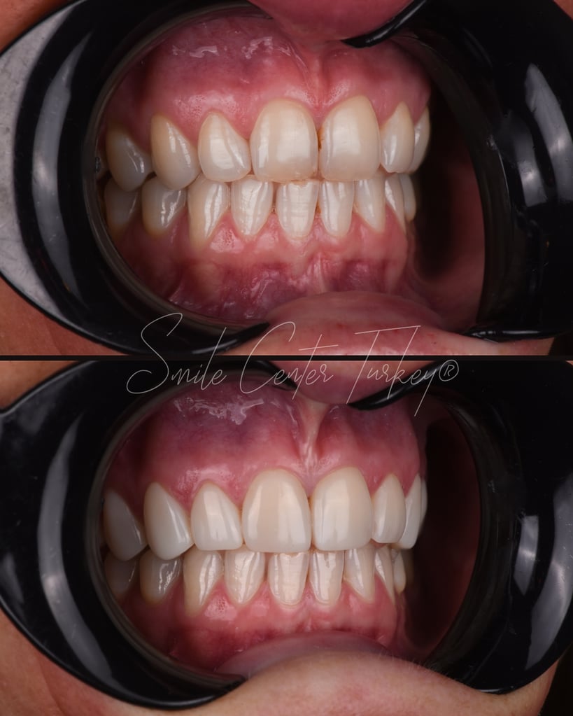 Victoria – Smile Center Turkey®