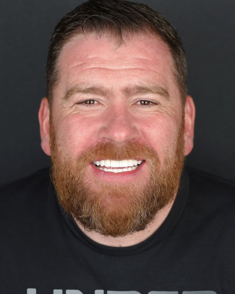 Portrait of a middle-aged man with short dark hair and a full beard wearing a black t-shirt, smiling broadly and showing bright white teeth at Smile Center Turkey.