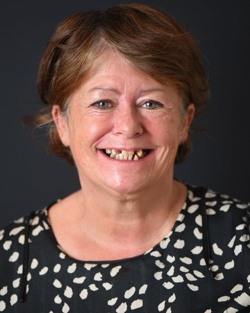 Portrait of a middle-aged woman with shoulder-length brown hair and bright eyes smiling with missing upper front teeth, wearing a black and white patterned blouse at Smile Center Turkey.