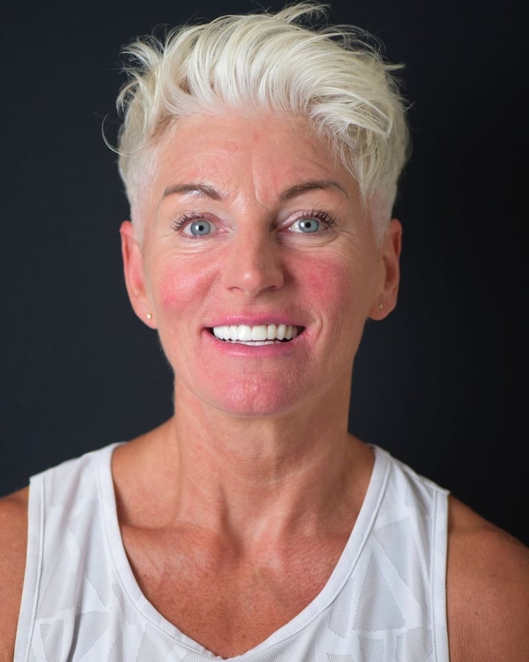 Portrait of a woman with very short white hair wearing a sleeveless white top, smiling brightly and showing straight white teeth after dental restoration at Smile Center Turkey.