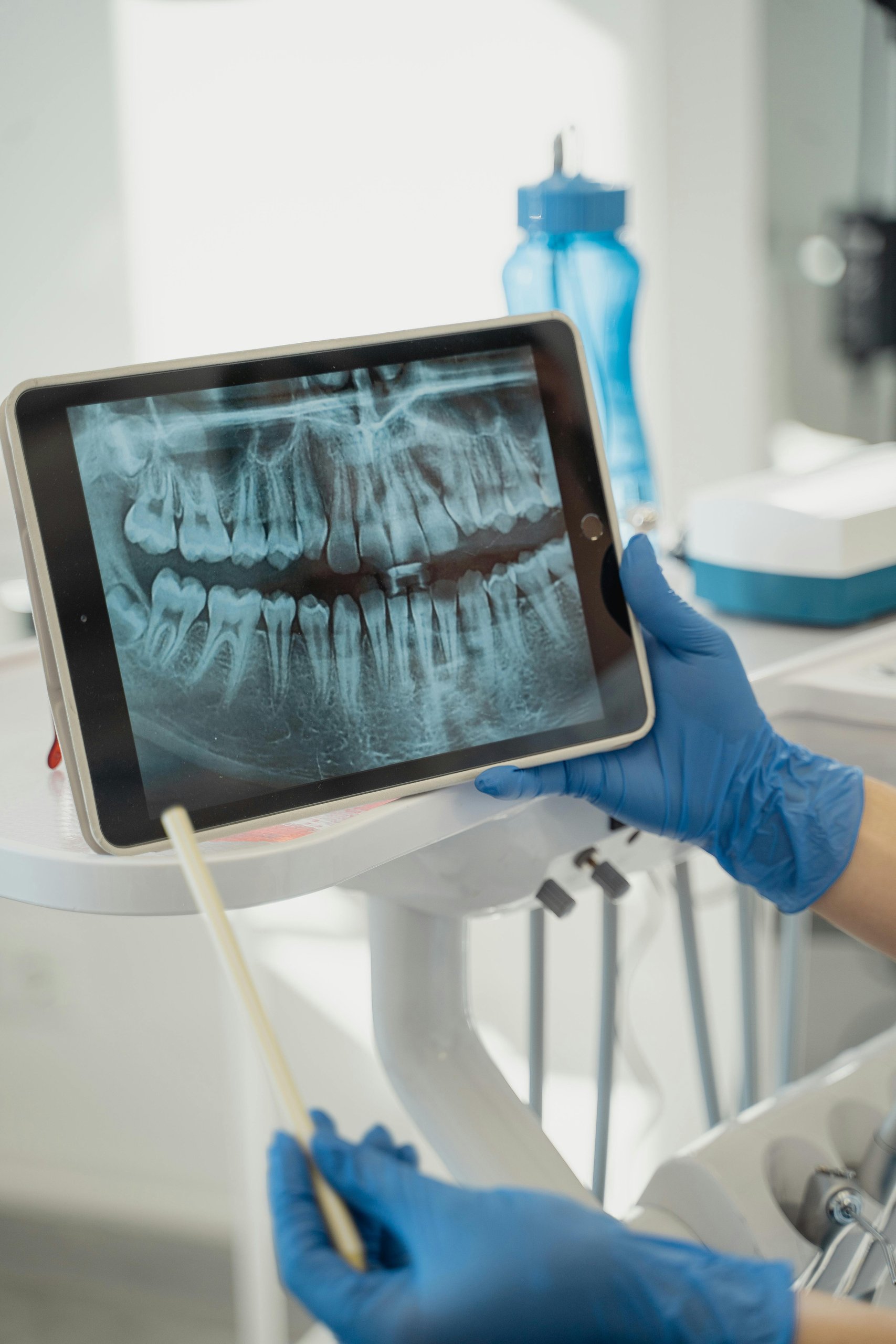 Dentist displaying dental X-ray on a tablet in a modern clinic.