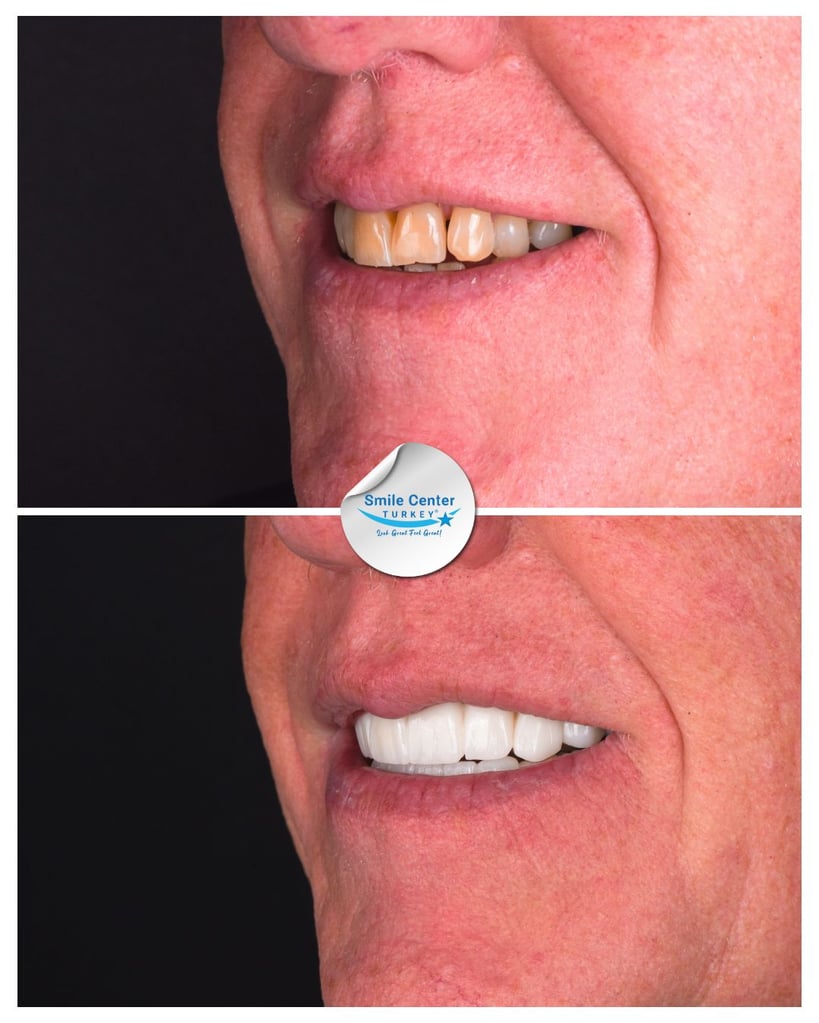 Timothy – Smile Center Turkey®