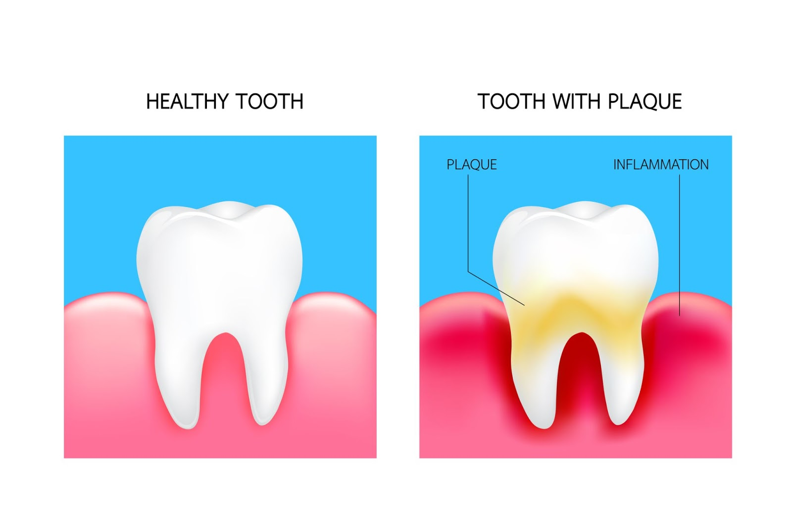 Brushing teeth correctly with circular motions