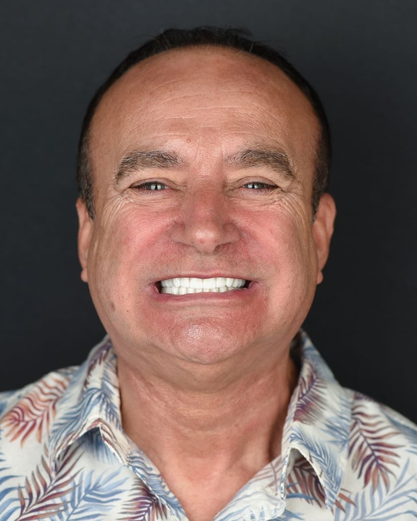 Portrait of a bald middle-aged man smiling broadly with bright white teeth, wearing a tropical patterned shirt at Smile Center Turkey.