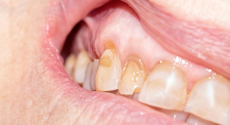 I1lXeUM7BK0FPI6w7kHIseNksin4Gi2BerROqHuP