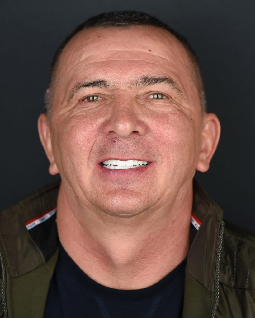 Portrait of a middle-aged man with closely cropped dark hair and wearing a black shirt and green jacket, smiling broadly and showing bright white teeth at Smile Center Turkey.