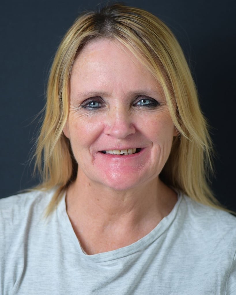 Portrait of a middle-aged woman with medium-length blonde hair smiling slightly, showing missing and discoloured front teeth before dental treatment at Smile Center Turkey.