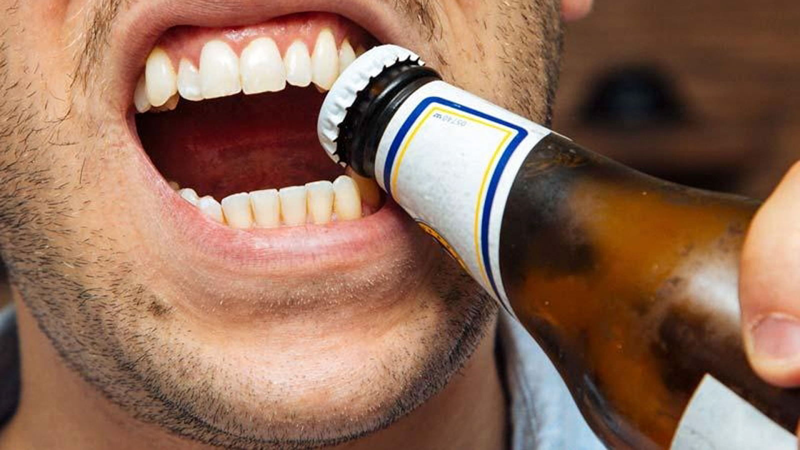 Damaged teeth from opening bottles or packages