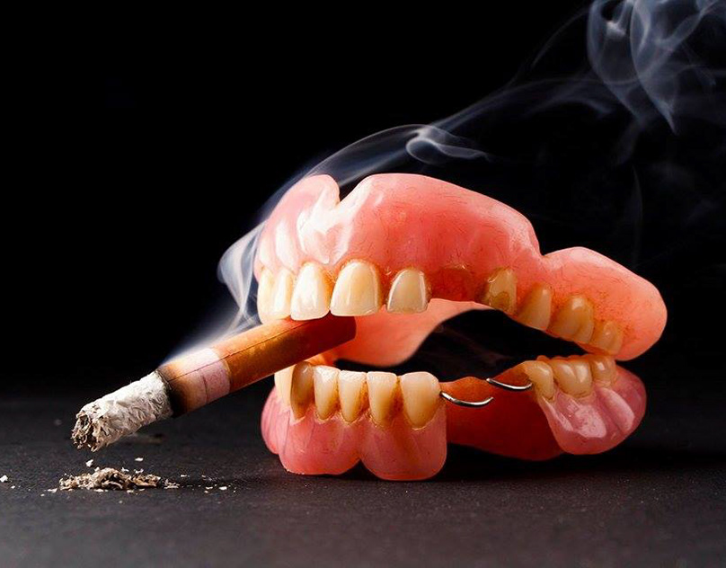 Effects of tobacco use on teeth and gums