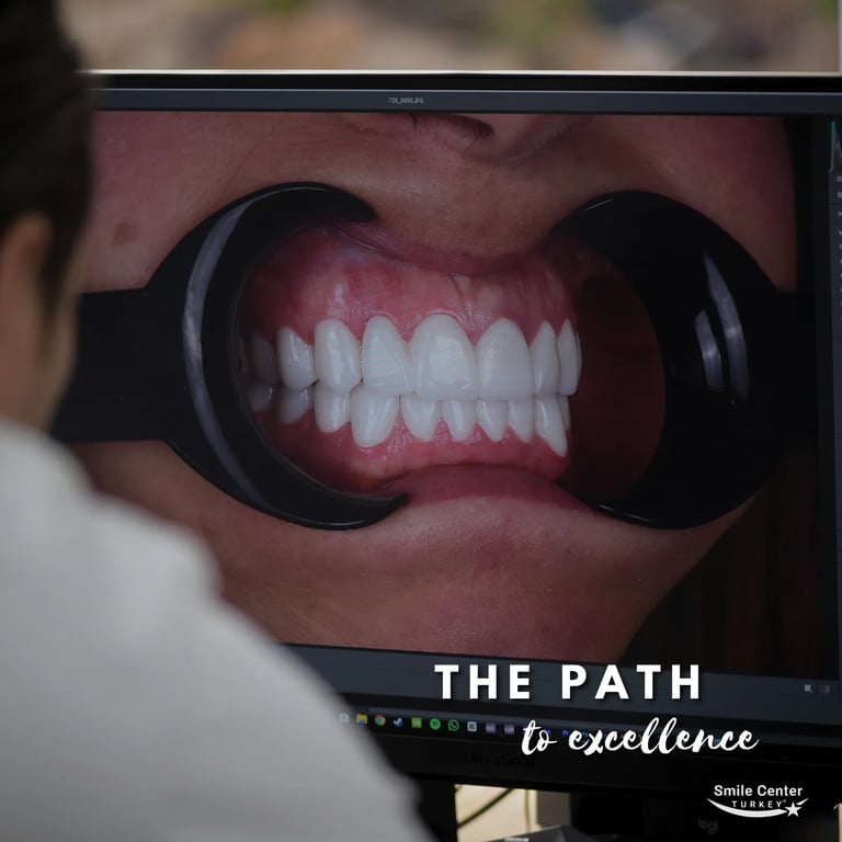 Digital treatment planning and case discussion in Antalya dental clinic