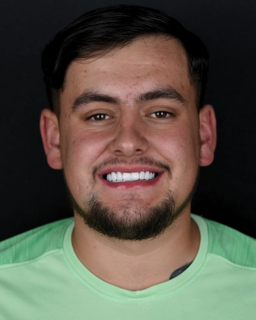 Portrait of a young man with dark hair, trimmed goatee, and bright white teeth wearing a mint-green shirt against a black background at Smile Center Turkey.