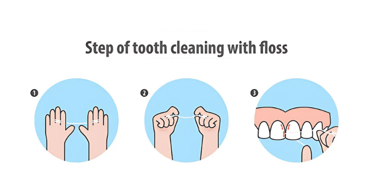 Daily dental flossing between teeth to remove hidden plaque