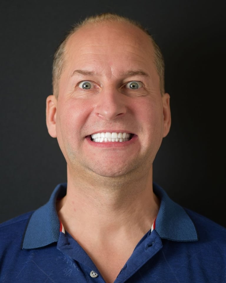 Portrait of a bald man with short blond hair on the sides wearing a blue collared shirt, stretching his mouth into an exaggerated wide smile to show his bright white teeth after dental restoration at Smile Center Turkey.