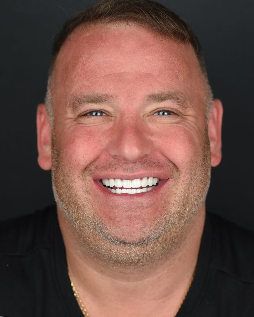 Portrait of a smiling middle-aged man with short blonde hair and trimmed beard wearing a gold chain and black shirt, showing bright white teeth at Smile Center Turkey.