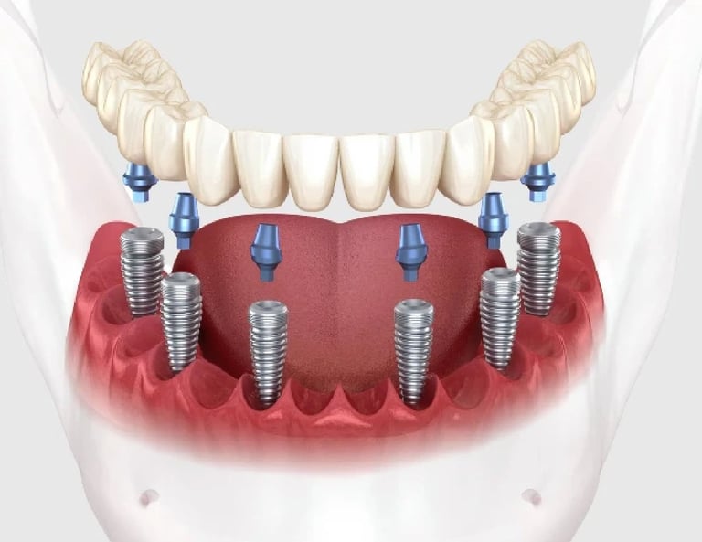 Before and after cosmetic surgery at Smile Center Turkey