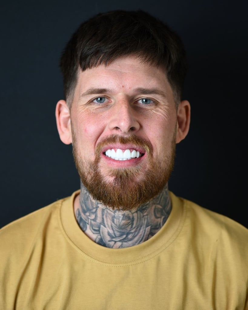 Anthony – Smile Center Turkey®