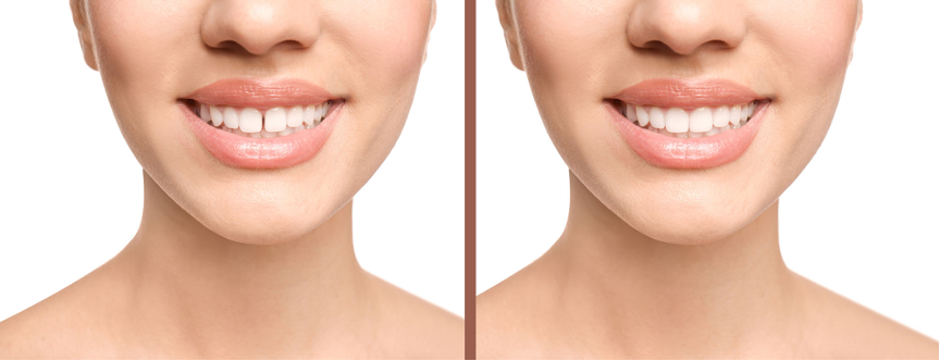 sZv1JG91Lg06fPjaZKGtZo9CF6fSHqyLDMSpyE70