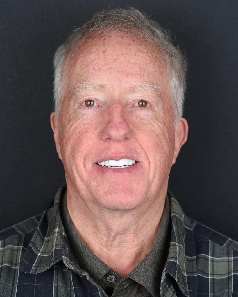 Portrait of an older man with short gray hair and freckles smiling widely, showing bright white teeth, while wearing a green plaid shirt at Smile Center Turkey.