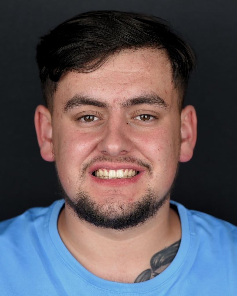 Portrait of a smiling young man with a short beard and moustache wearing a blue shirt at Smile Center Turkey.