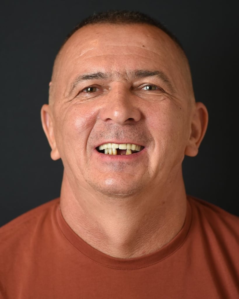 Portrait of a middle-aged man with closely cropped dark hair wearing a rust-colored shirt and smiling broadly, showing yellow and missing front teeth before dental treatment at Smile Center Turkey.