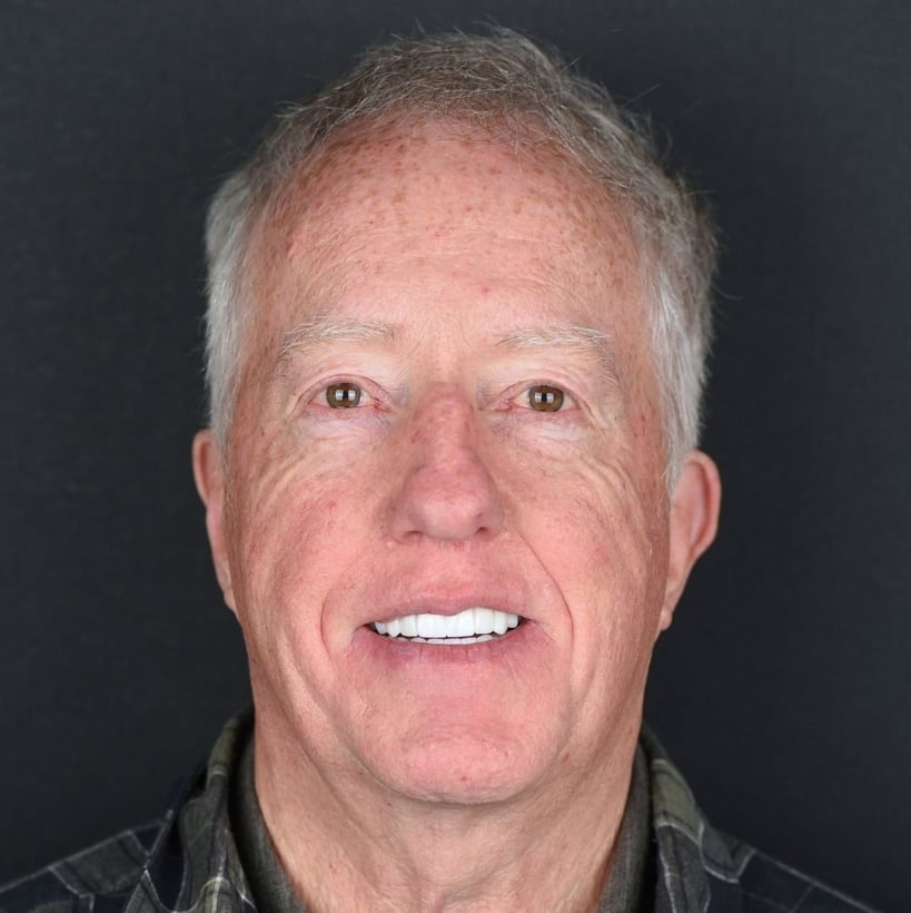 Timothy – Smile Center Turkey®