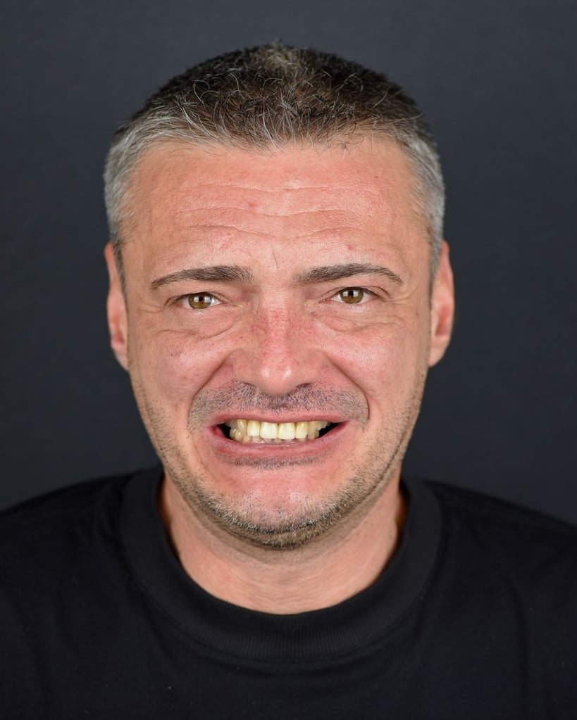 Stoian P. – Smile Center Turkey®