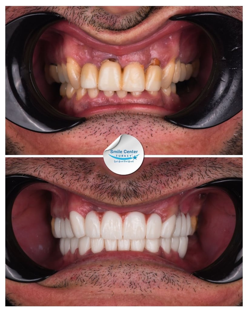Stoian P. – Smile Center Turkey®
