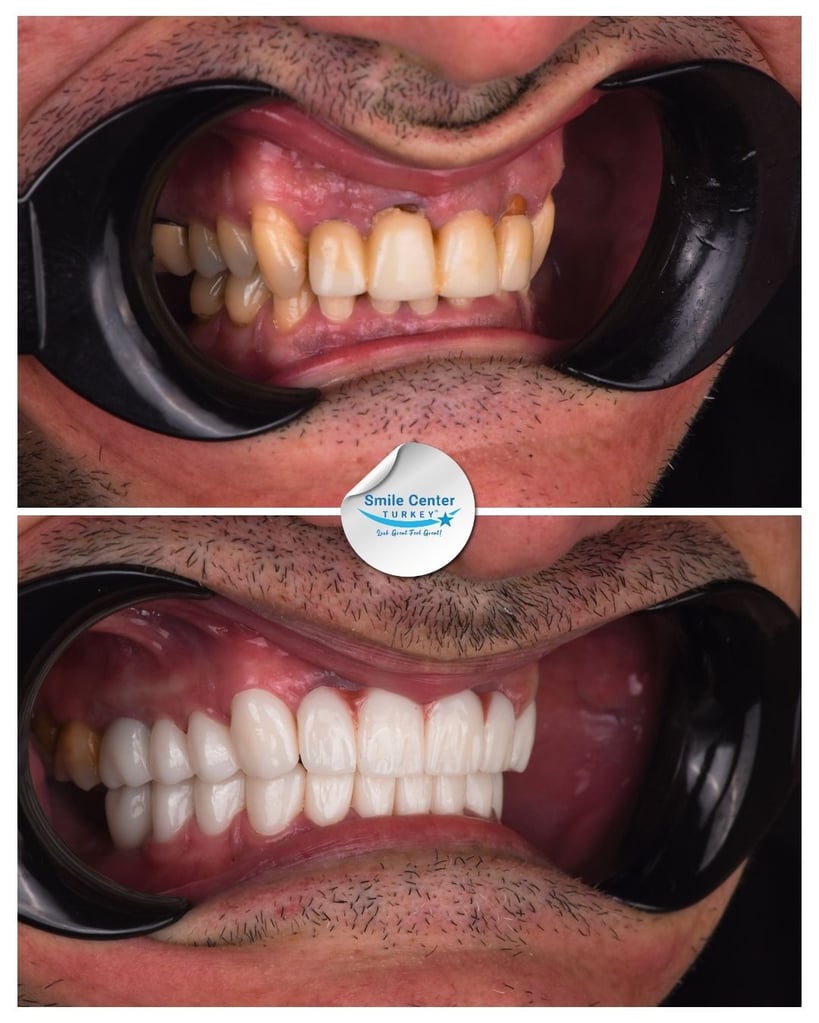 Stoian P. – Smile Center Turkey®