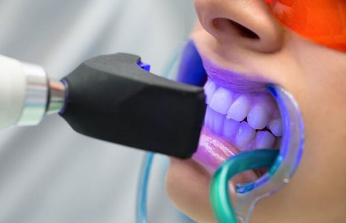 Blog – Smile Center Turkey®