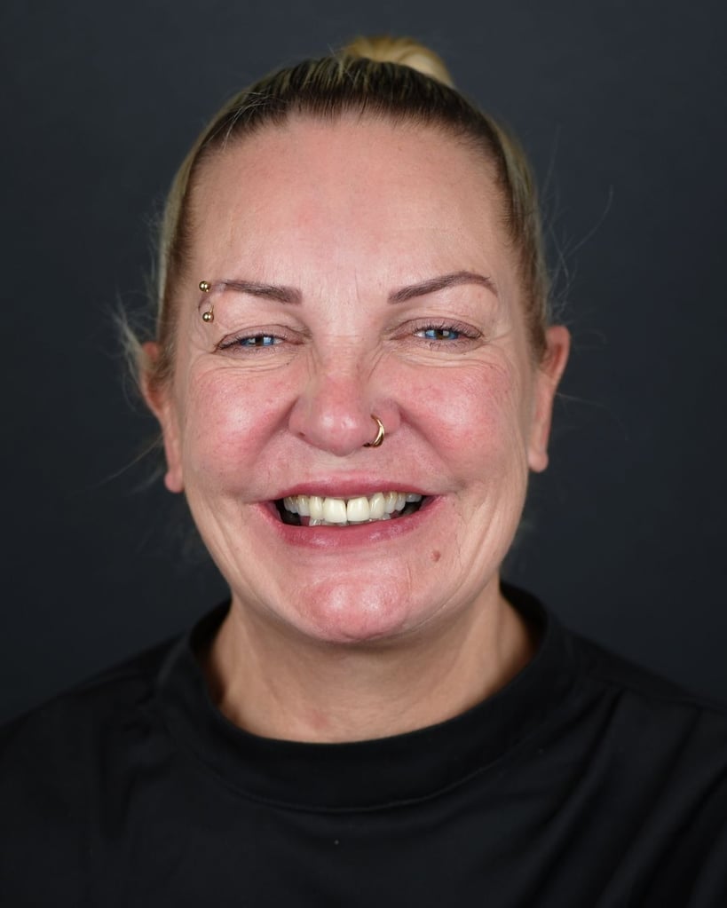 Toni M. – Smile Center Turkey®