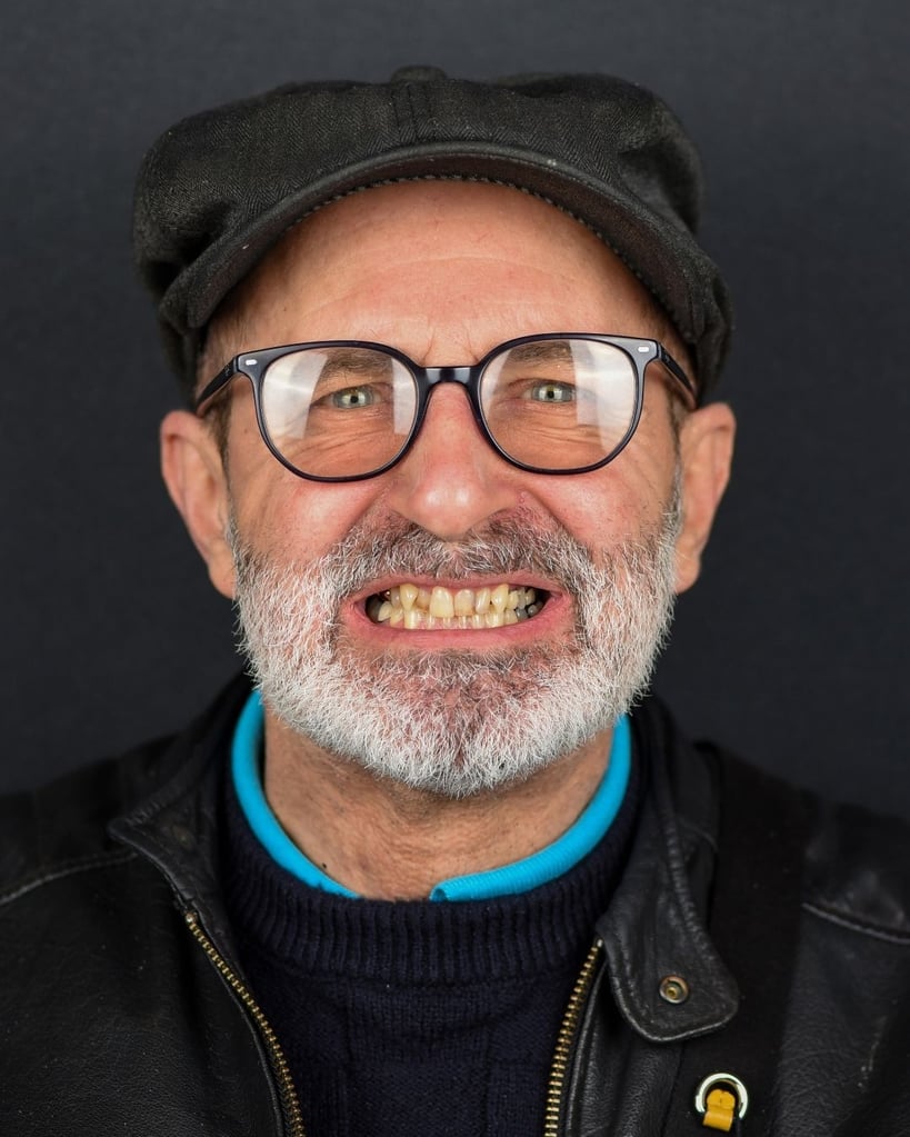 Nicholas K. – Smile Center Turkey®