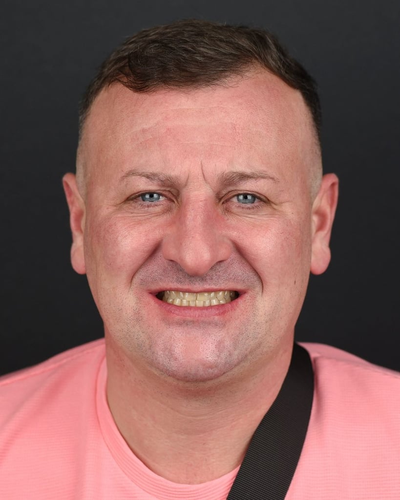 David H. – Smile Center Turkey®