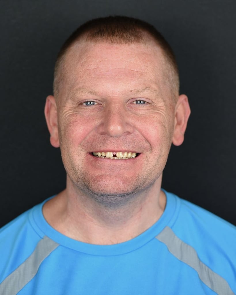 Dwayne O. – Smile Center Turkey®