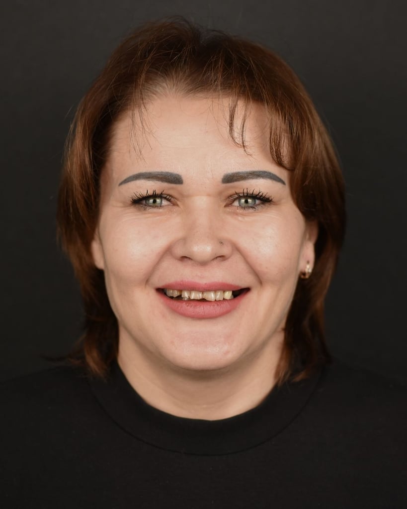 Nicolae S. – Smile Center Turkey®