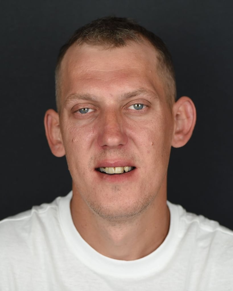 Aivaras V. - Centro del sorriso Turchia