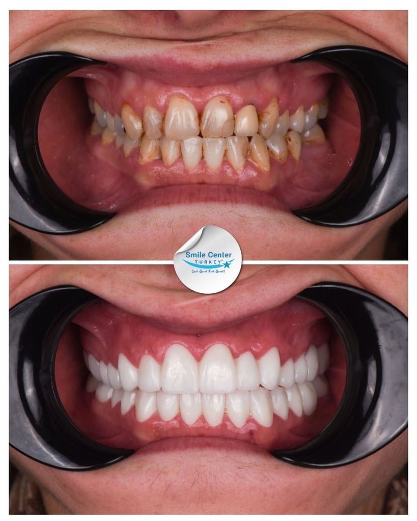 Rioni S. - Centro del Sorriso Turchia