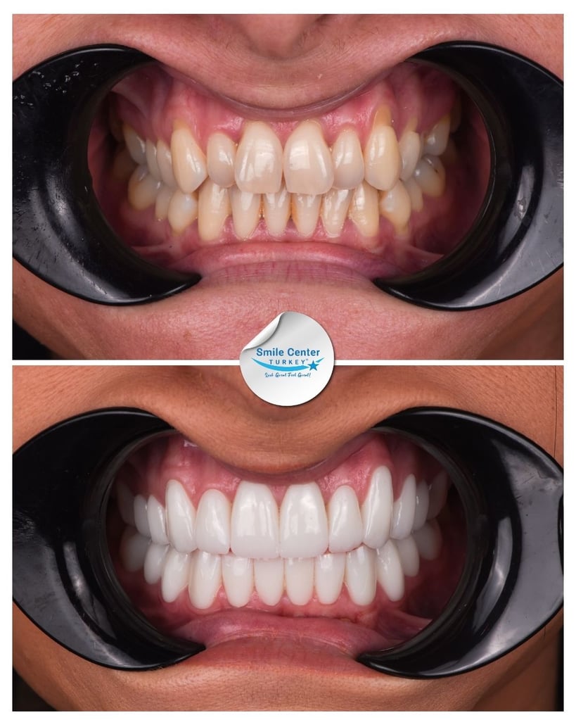 Lauren P. - Centro del sorriso Turchia